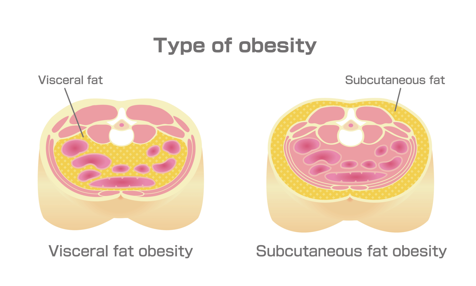 Visceral fat