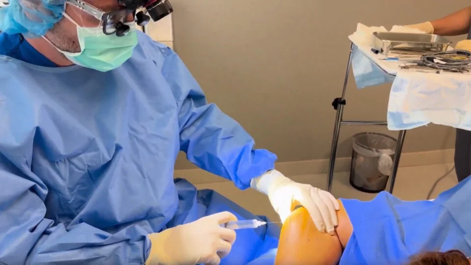 Lipoma removal video