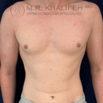 after front