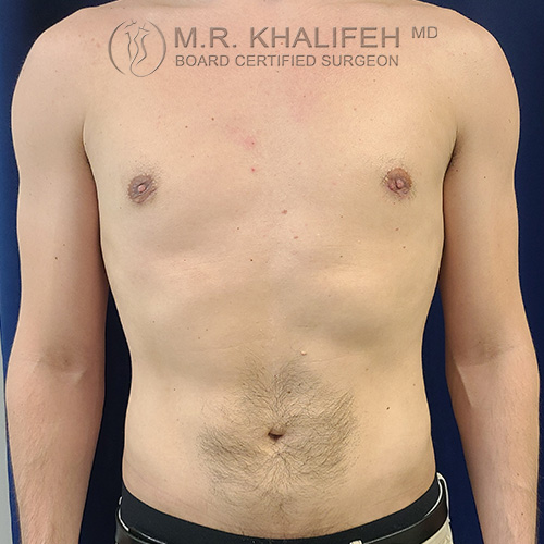 1621352157 1 after.jpg