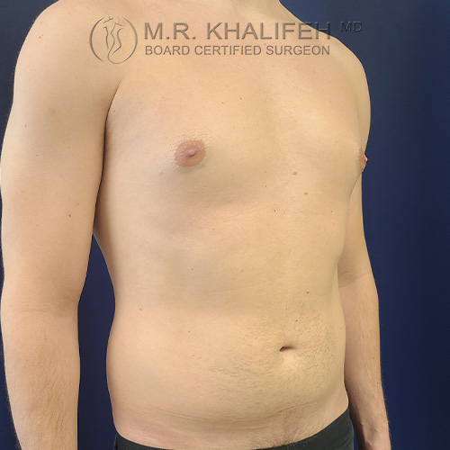 1621352162 2 before.jpg