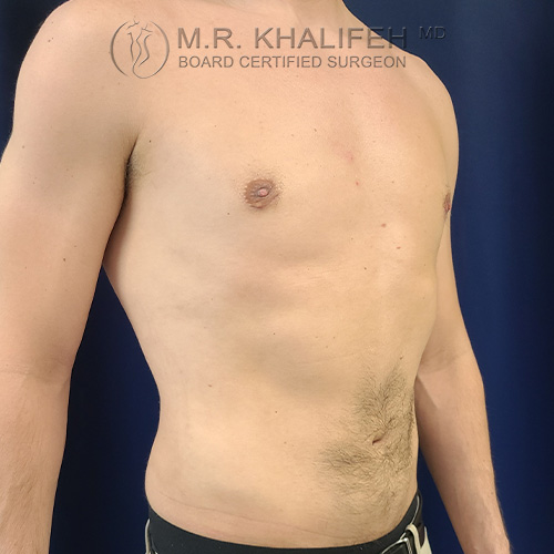 1621352167 2 after.jpg