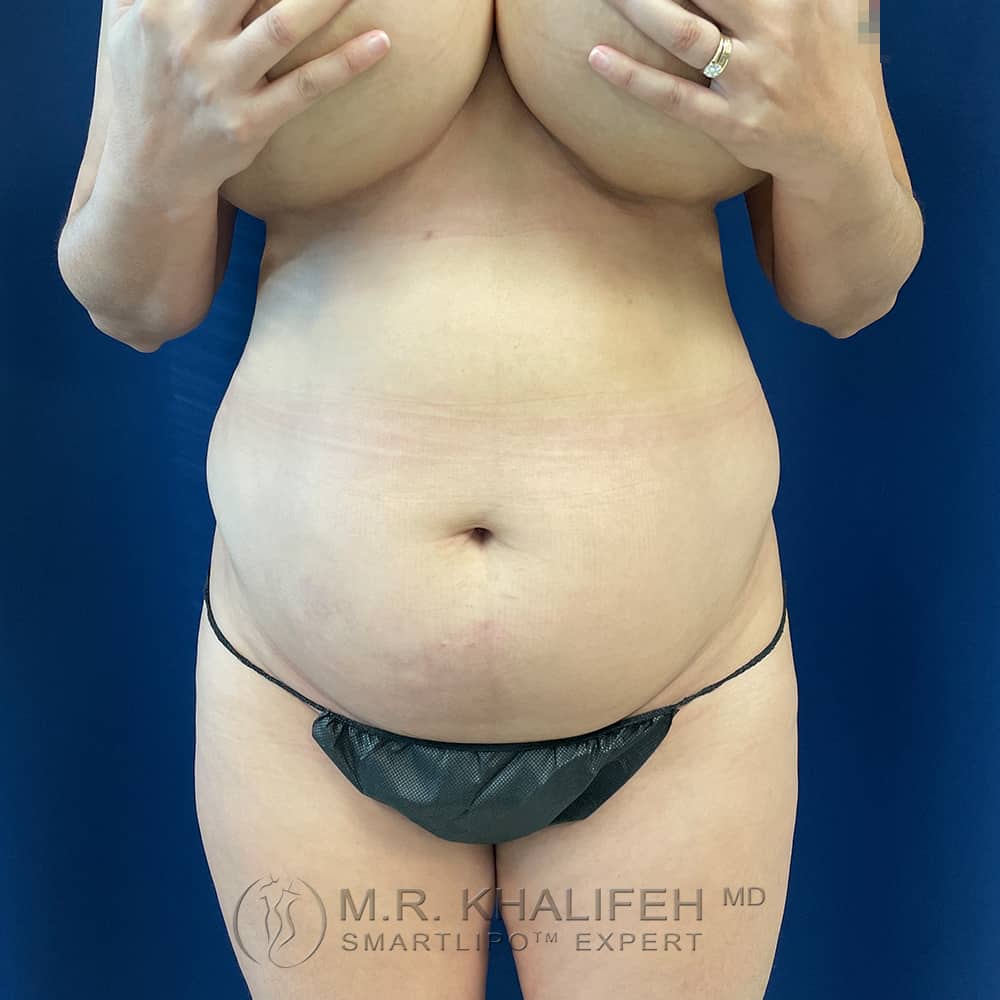 1656104173 pre 1.jpg