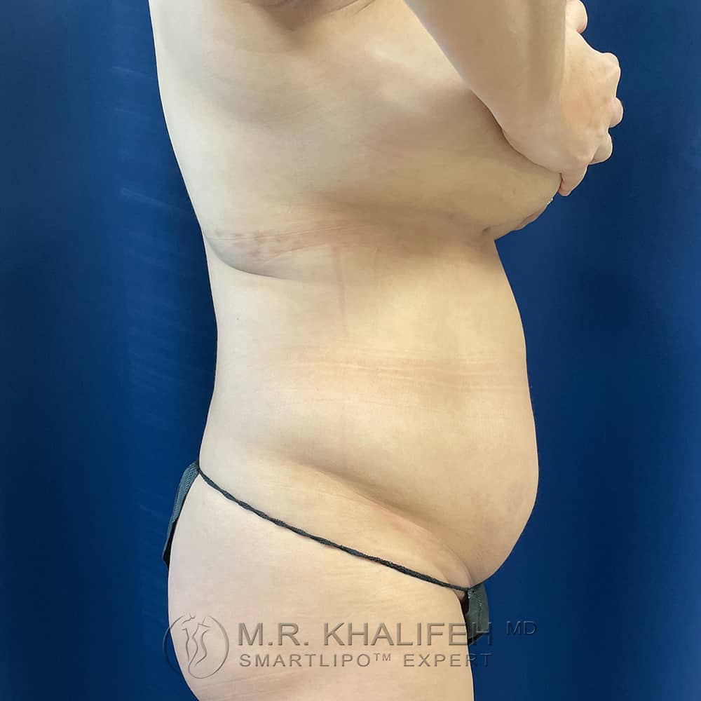 1656104177 pre 2.jpg