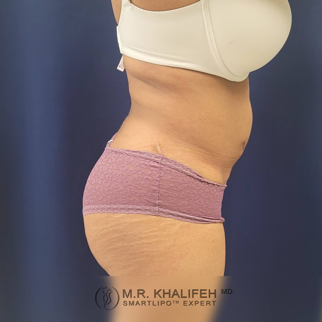 1656104369 post 1 scaled 1.jpg