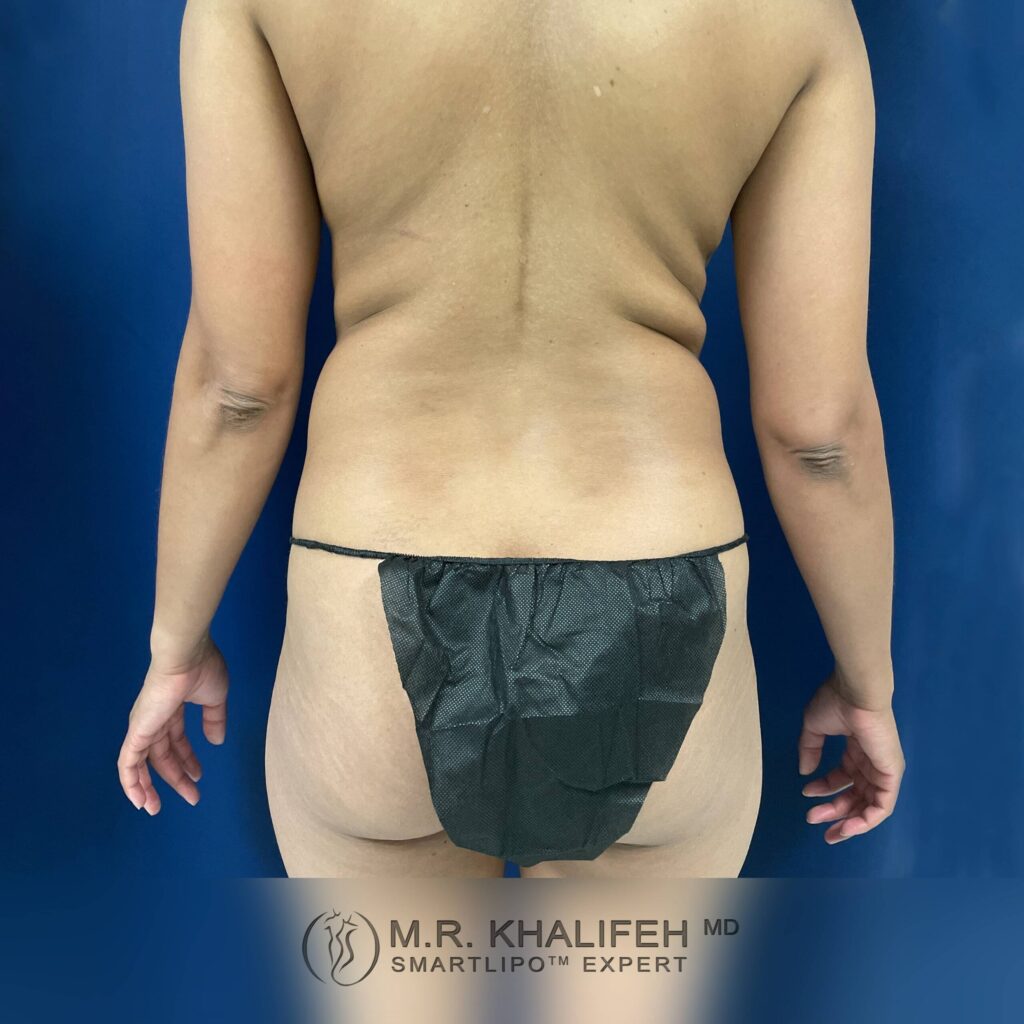 1656104392 pre 3 scaled 1.jpg