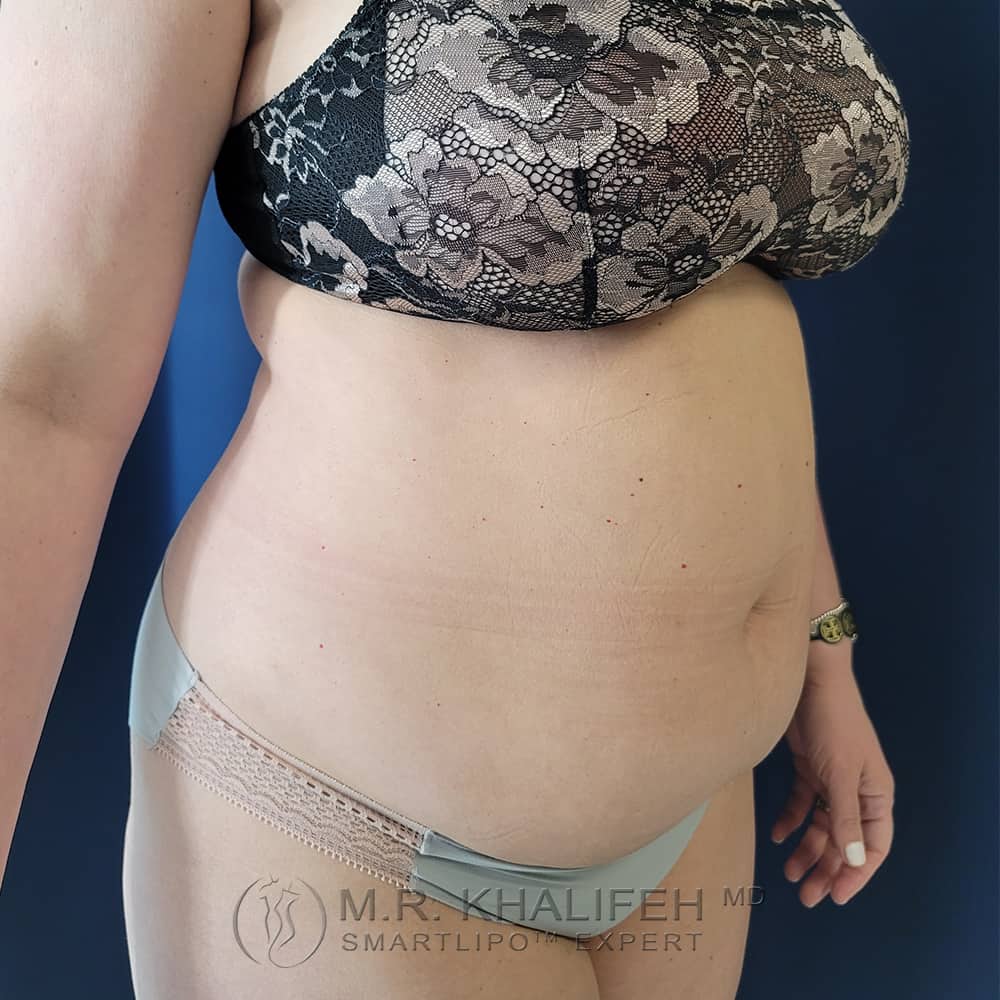 1657309113 pre 2.jpg