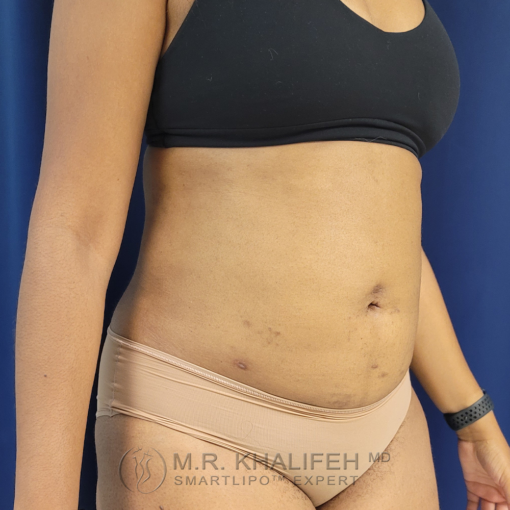 1658886660 post 2 3.jpg