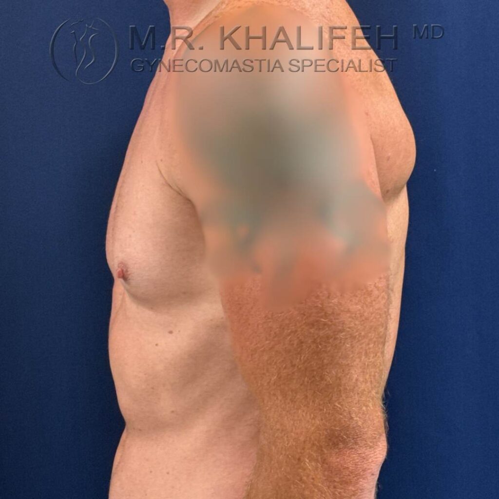 1 Side View Left – Before.jpg