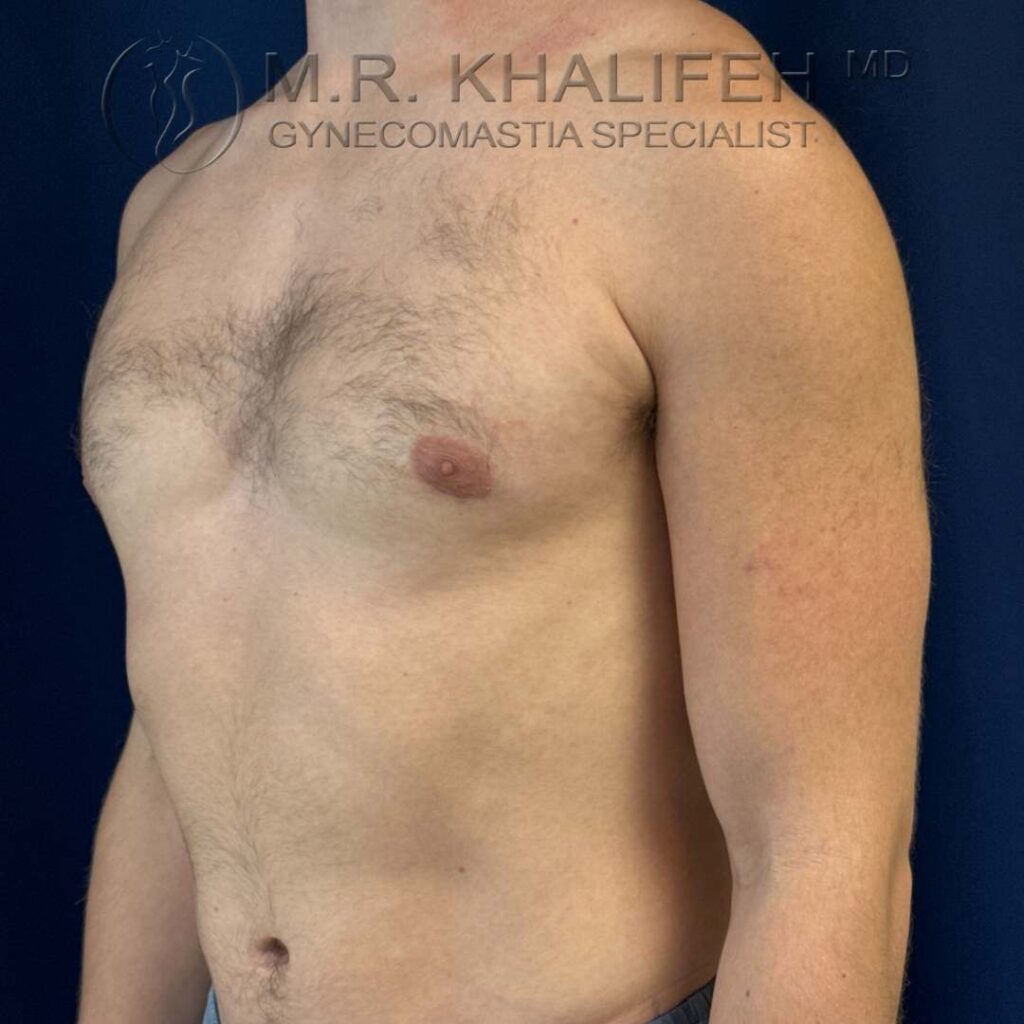 10 three quater side view left after.jpg