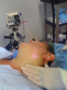 1582932243 below the ear lobe incision