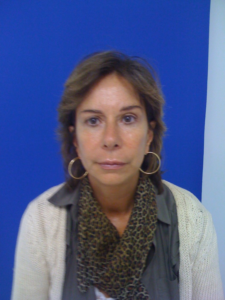 1583261820 liquid facelift image