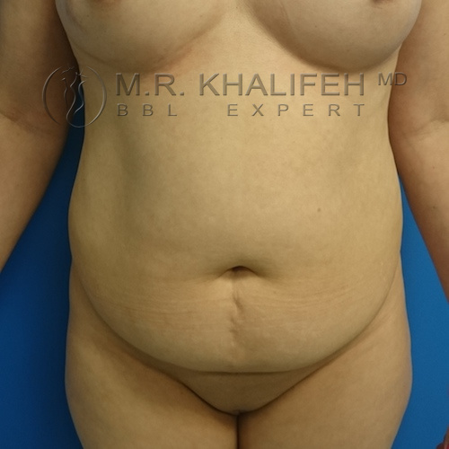 1583974139 f6fda6ac 4681 4a1f b38e b5d5c90495fb.jpg
