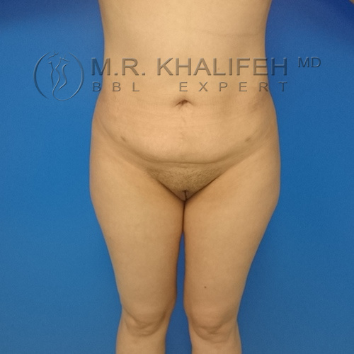 1583974144 04bde156 9d5d 4383 96b3 ef822837f74c.jpg