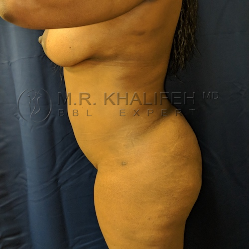 Maker:0x4c,Date:2017 11 19,Ver:4,Lens:Kan03,Act:Lar01,E Y