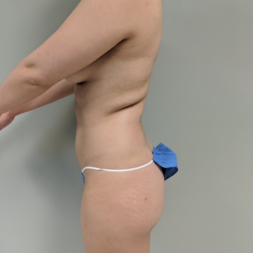 1583975353 3942b48a e2dd 49bc 84ab 205cec3c842c.jpg