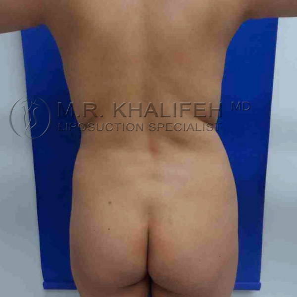 1584030634 21defe37 cacf 4bda 8074 c795e8917e2c.jpg