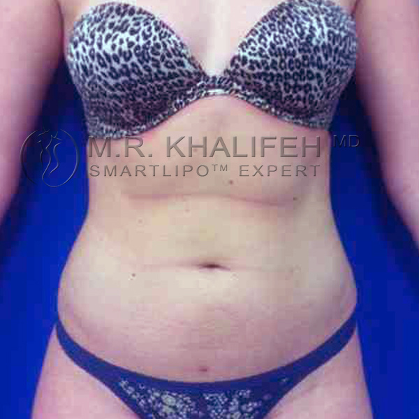 1584030697 5a9215f0 e54b 4260 89e1 3ef12f067a3e.jpg