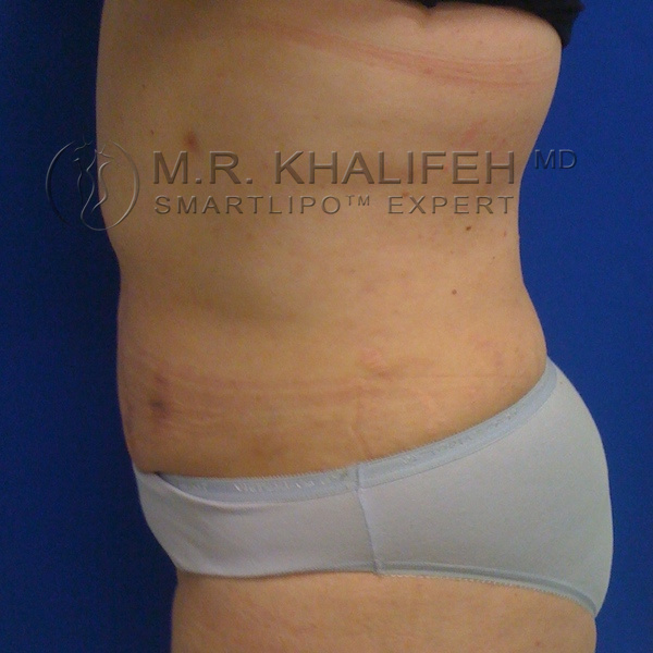 1584031154 398f94a3 5fc2 41ee 8977 ff4b9260df0b.jpg