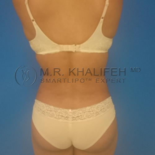 1584032445 010f1fb4 a967 44bc a034 c0a2e29e4d6f.jpg