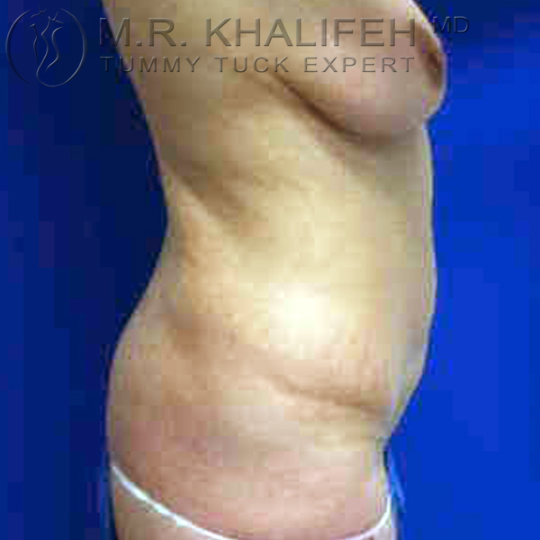 1584033432 8abbc908 a2a2 412e 909d 9a74c3ba2d6d.jpg