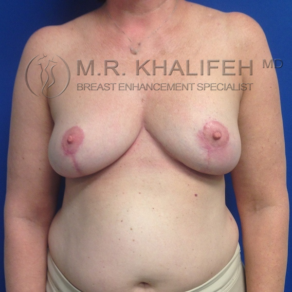 1584033459 ee42e82b e9dd 4815 b751 891cab008af1.jpg