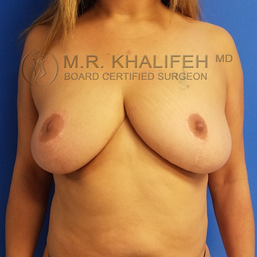 1584033665 6421ccb6 d2ef 4a77 8f6b 5f1e2643ebe3.jpg