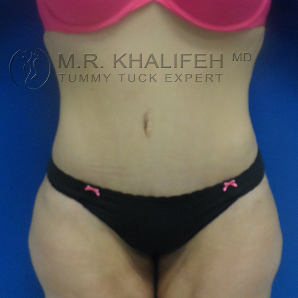 1584035165 c3d7b1bf 7d06 48ea b1bf c7dda6d0a6f3.jpg