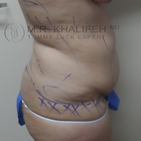 1584035190 9b45dd61 ac59 49b8 a6fe d5bf9bcdd02b.jpg