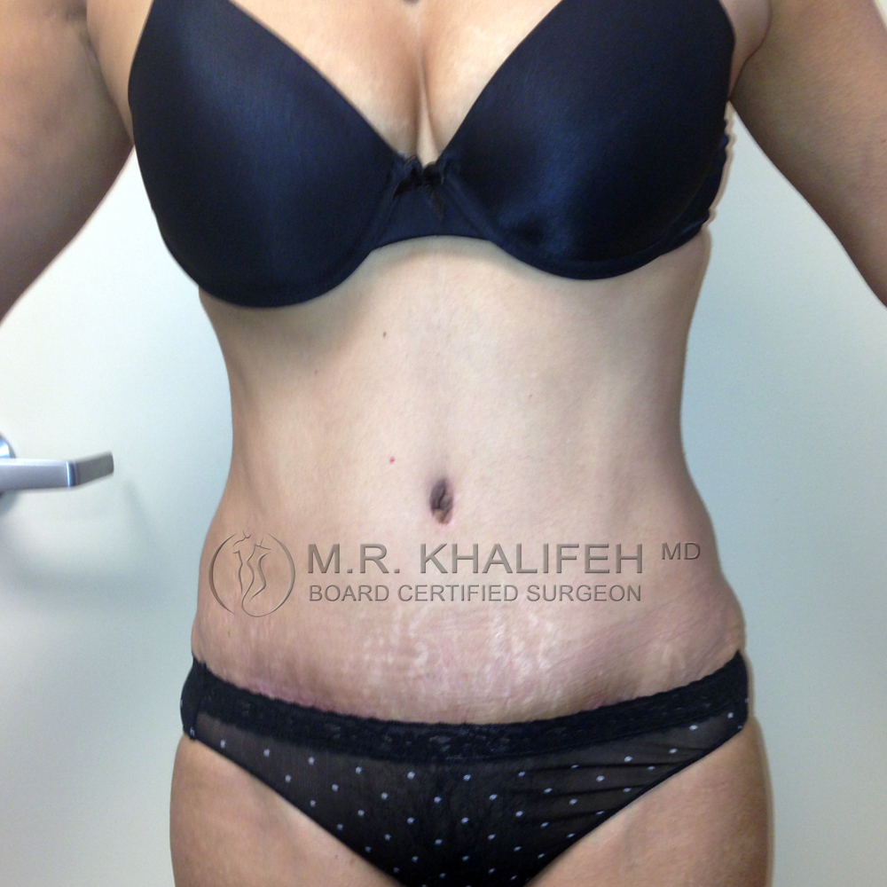 1584035267 f0dbb2ad fddf 4550 9b92 4c253ee1a9f8.jpg