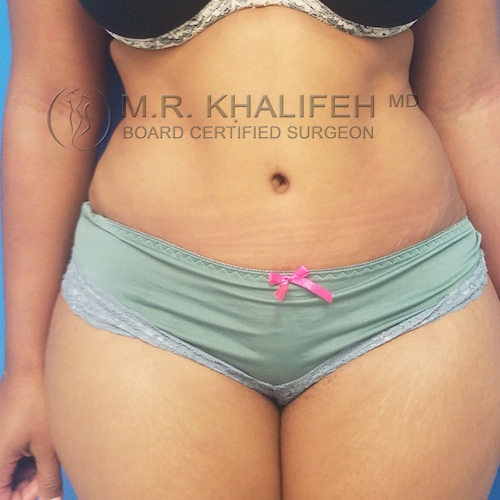 1584036532 17393e84 6d24 48c3 b5e6 eac4a4281cc7.jpg