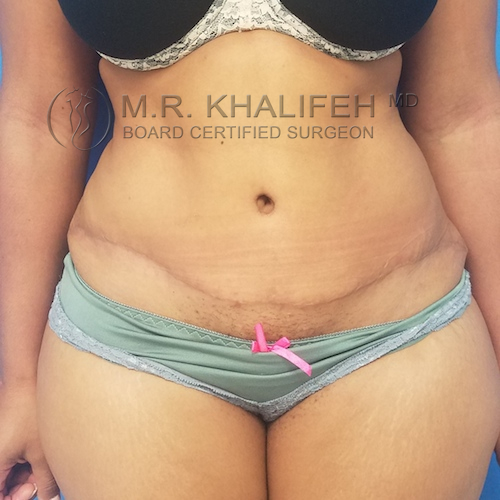 1584036580 204d0625 f7a4 41e3 bc27 ceef66d0cb69.jpg