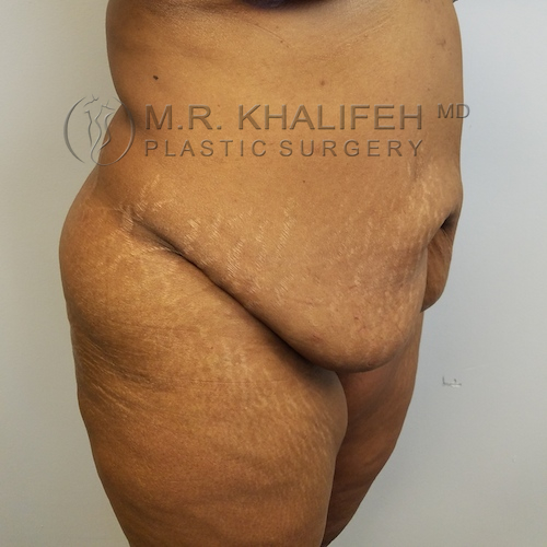 1584036620 e137f84b c9c0 474f a8f1 69fa085883e1.jpg