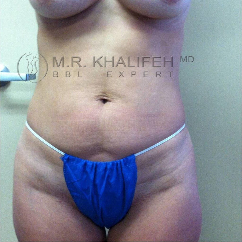 1584038988 4689e637 ffb6 418b a21c 3b95b9bdfa05.jpg