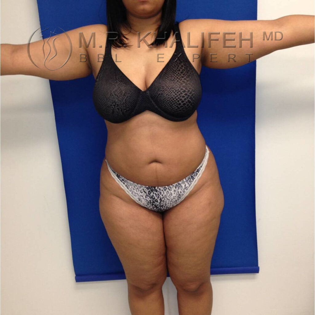 1584039728 fe2d7273 acc7 41de aecf 23f96cdd2e18.jpg