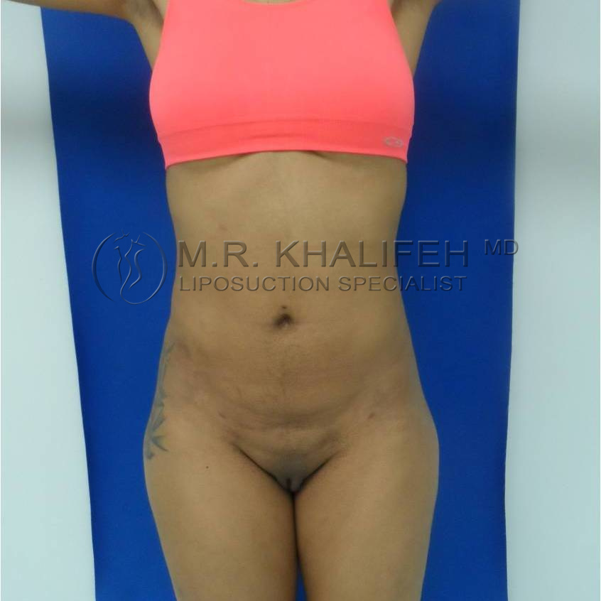 1584040420 3c43e52b e59b 4c64 bb52 d5474dcf25a5.jpg