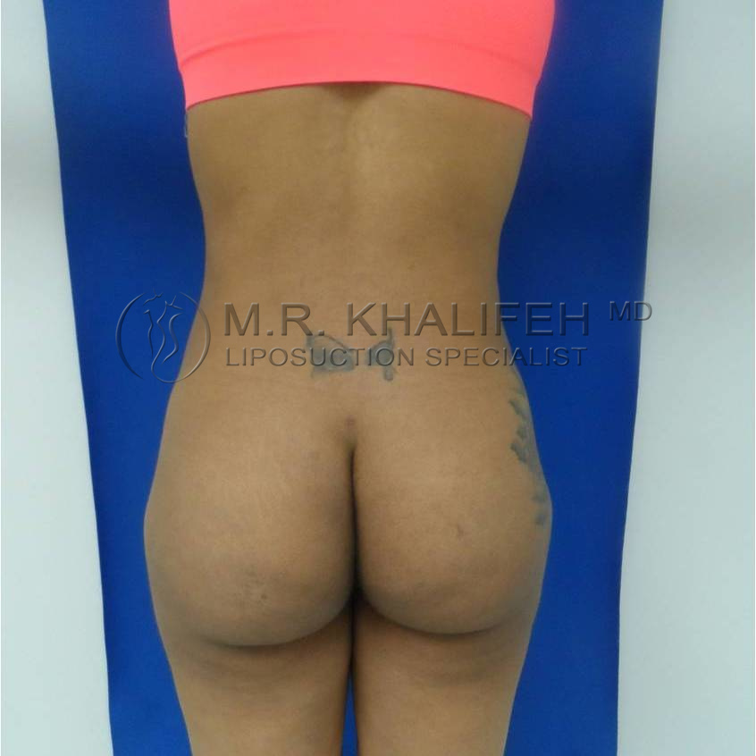 1584040435 772ea200 3063 4f54 8570 fa6bd19e28f5.jpg