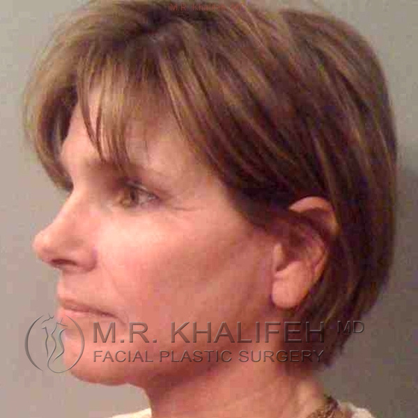 1584041439 2687826d eb91 49cf 9ab9 dacba2977556.jpg