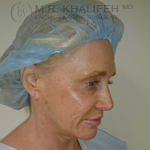 1584041517 f53bfb66 19fc 4ff1 bec6 26db54c7d29f.jpg