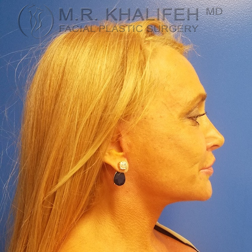 1584041523 7d822a2c b6e0 4244 b765 f40cc4bb4e83.jpg