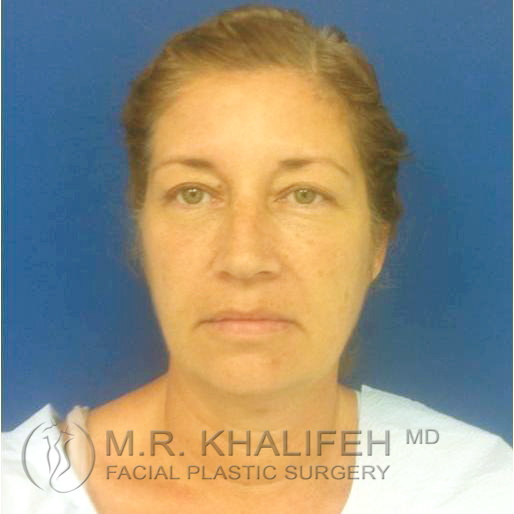 1584041681 a9c6980b 2dd6 45fd 8984 8e05f49a6e0b.jpg