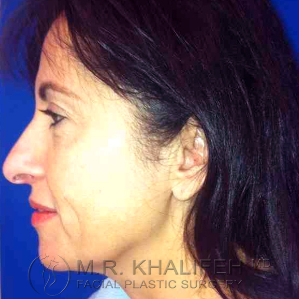 1584041815 6b5d118d 6c16 41bf aab9 fde03a9e9167.jpg