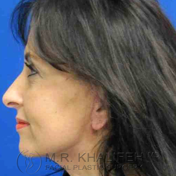 1584041823 b0891dbf f173 4f2e 9a68 21a77dfc91fa.jpg