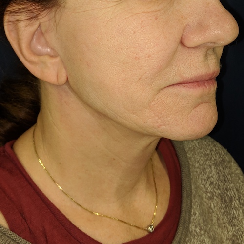 1584041864 103774ca 23b0 408d 8ef3 4e36fcfe80b9.jpg