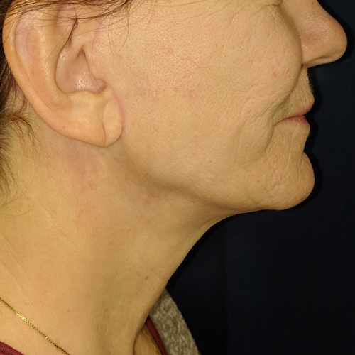 1584041876 4c76cee8 8384 42e3 b997 8068de9ca0c2.jpg