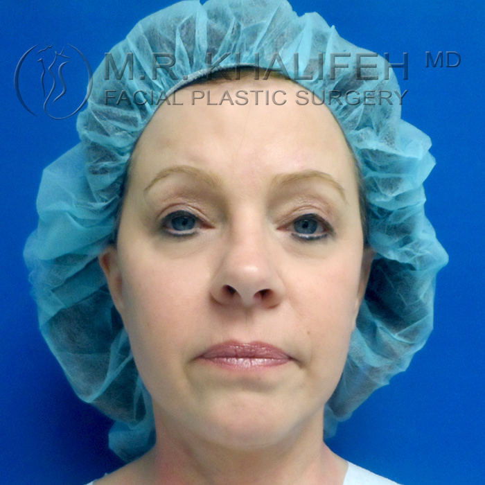 1584041931 bab9ca7e 0949 4642 899f 19d83458e38d.jpg