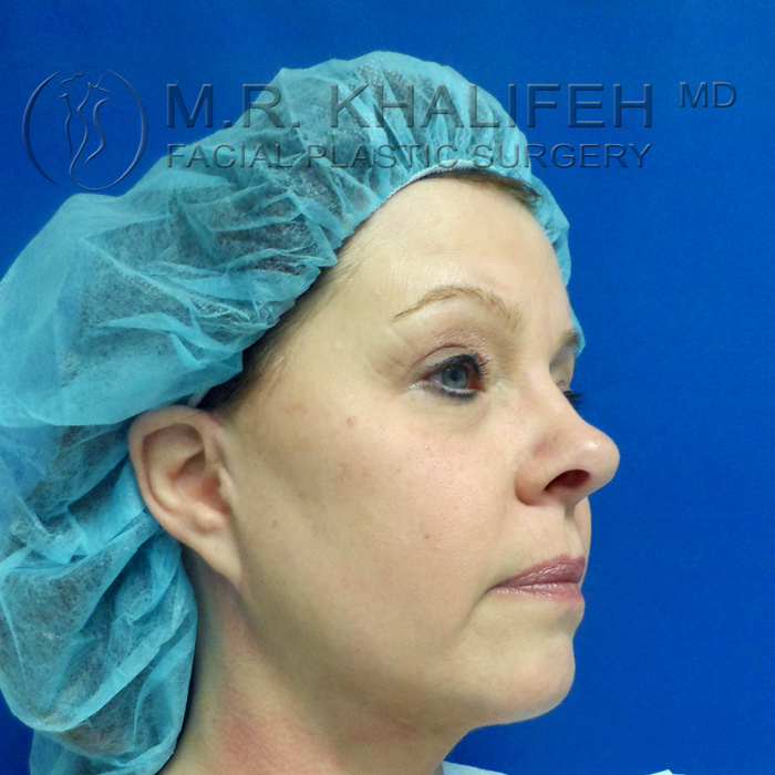 1584041948 46689913 b060 4fa5 b2f4 e714f5ecef7c.jpg