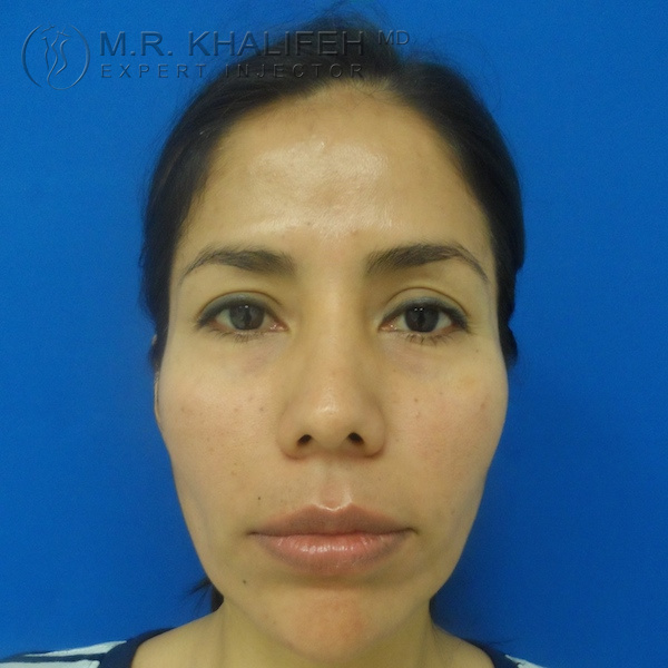 1584047216 77abc64e 4a0a 4ad4 8380 31b1d94688b1 1.jpg