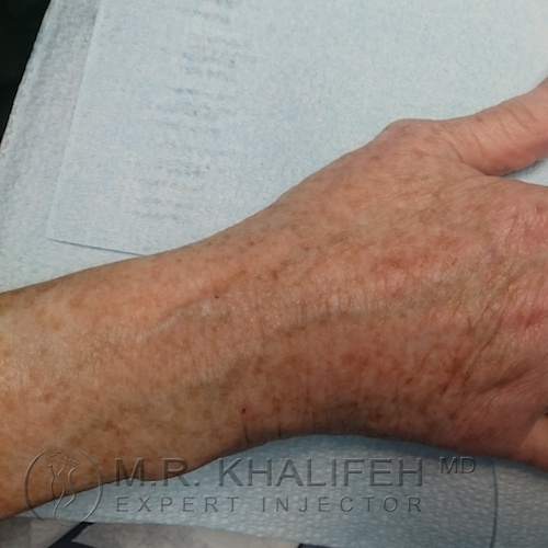 1584047318 ca78355d d176 4ad1 ad43 f4d8fcdb8a57.jpg