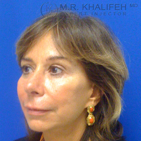 1584047332 d437d6a0 c2de 482e 8442 bb90486bbca9